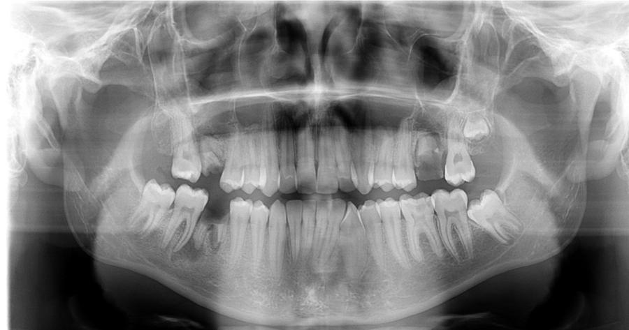 Radiografia panorâmica, sem identificação